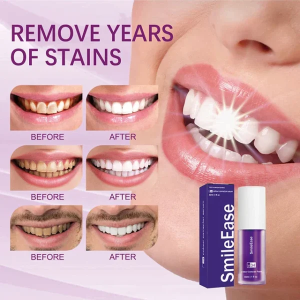 Hismile v34 Color Corrector Serum - Instant Teeth Whitening - Image 5
