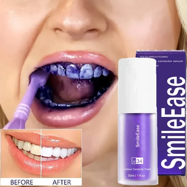 Hismile v34 Color Corrector Serum - Instant Teeth Whitening - Image 6